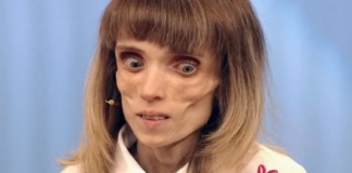 Боялась поправиться: Как выглядит теперь 17-килограммовая Кристина Корягина, которая приходила на выпуск "Пусть говорят"